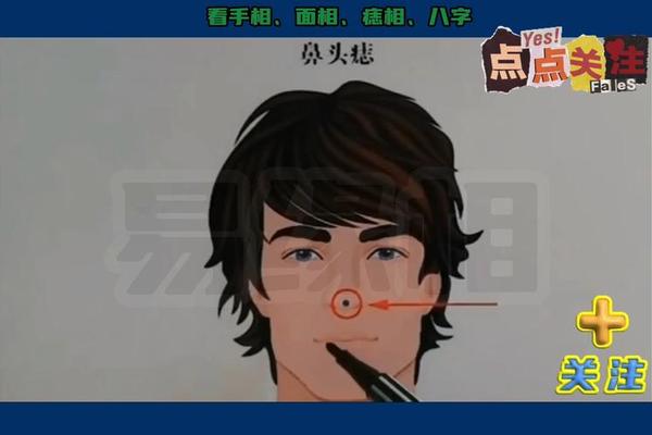 麻衣神相之男性右侧太阳穴有痣_男士右边太阳长痣好吗