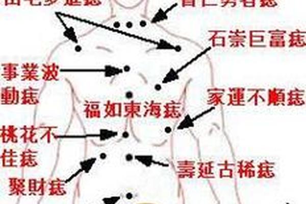 全身痣相大全图解痣缘宫;男人身上痣相大全图解