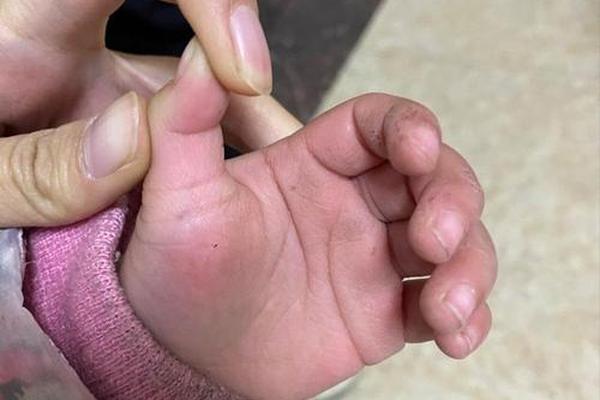 女小孩大母纸痣相,小孩吃大拇指代表什么 女小孩大母纸痣相,小孩吃大拇指代表什么