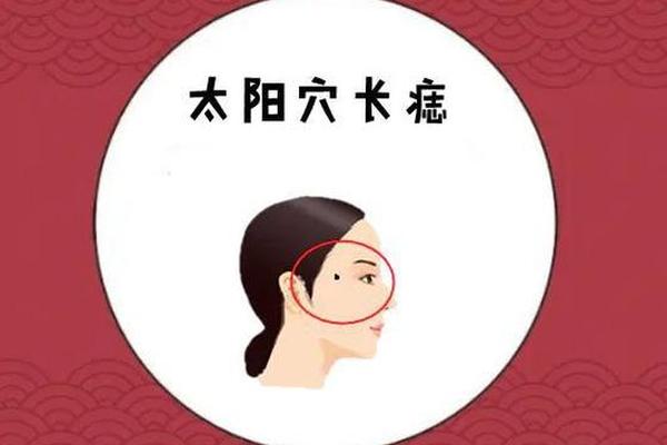 女人太阳穴痣相 女人右边太阳长痣好吗