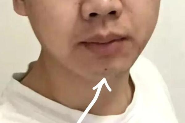 男人左乳上有痣痣相,左胸有颗痣意味着什么