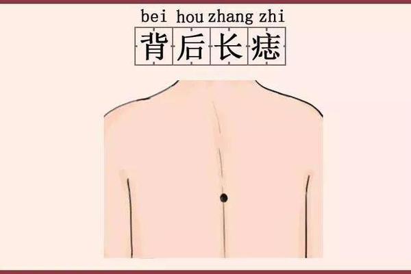 女人颈部痣相是好是坏—颈部长痣图解女性