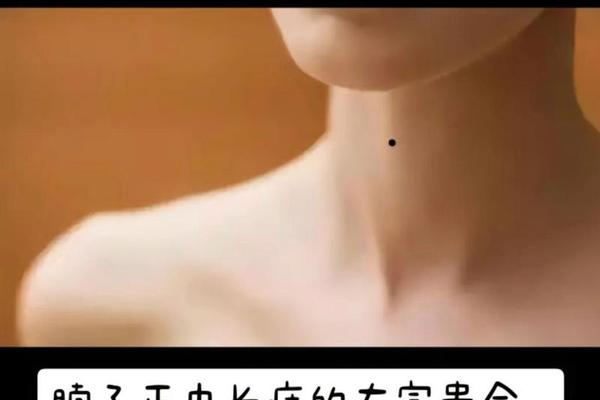 男性脖子痣相图解-痣相、脖子痣的图解大全
