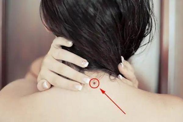女相后背中间有痣图解;女人背中间有痣代表什么