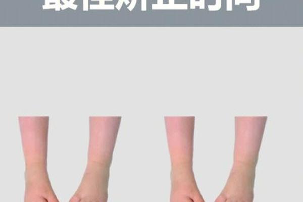 内八字脚如何矫正
