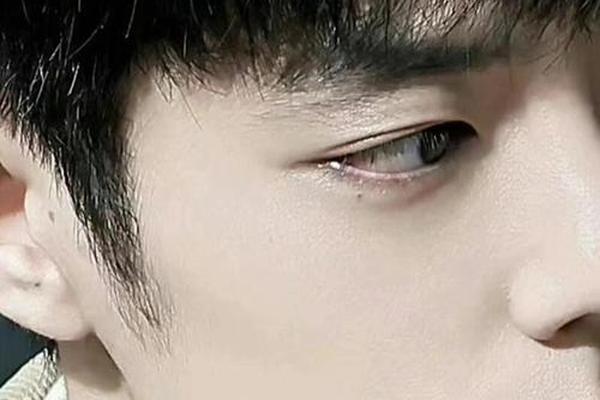 男人眼皮的痣相,眼皮有痣的男生