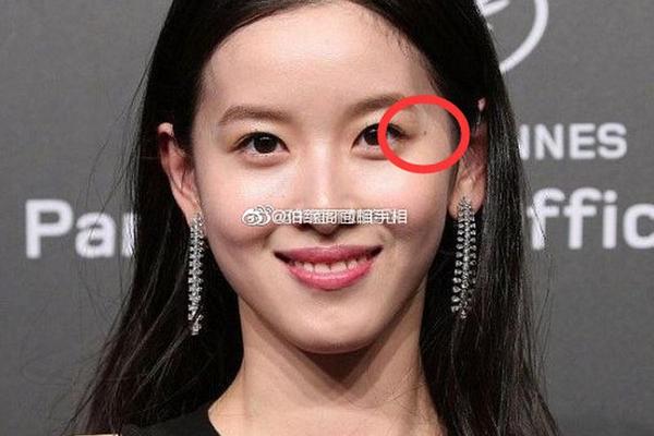 眼尾有痣的女人的婚相;为什么眼尾突然长个痣