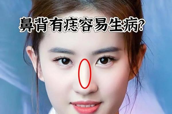 鼻上有痣是典型的美人相-鼻子上有痣的人