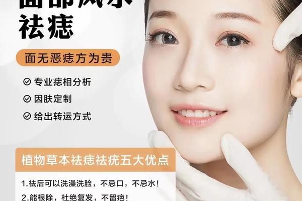 痣相美学馆 拍照测痣相的app 痣相美学馆 拍照测痣相的app