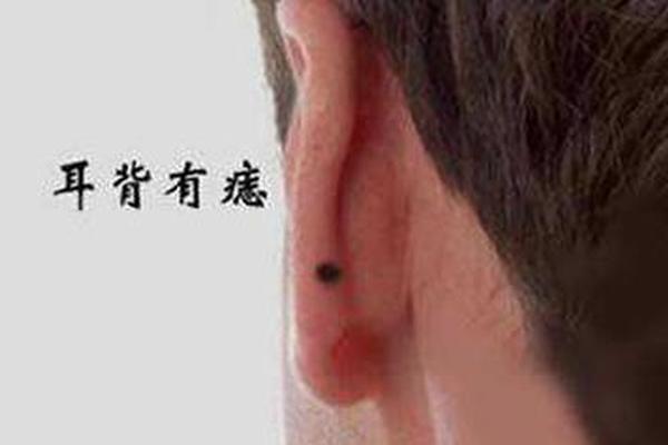 女人耳后有痣相最准图、女人脸上的痣图解准吗