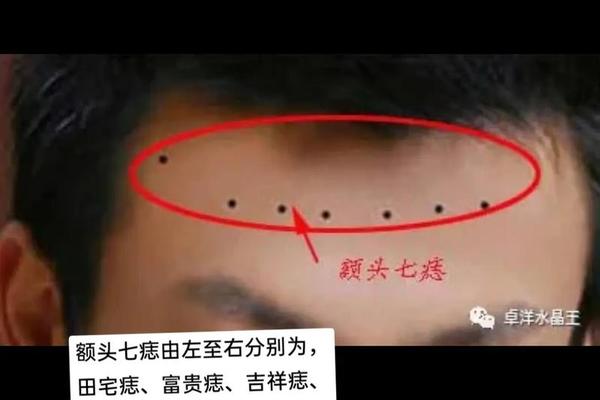 男性额头痣痣相-男人脑门长痣代表什么