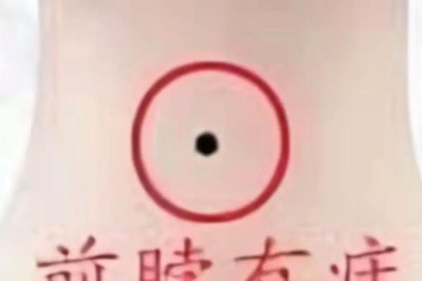 女生胸口痣相—男人左脖子痣相