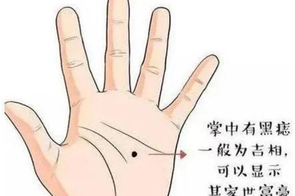 女孩子手上的痣相(手掌痣相图解) 女孩子手上的痣相(手掌痣相图解)