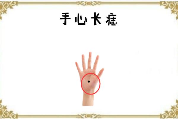 手掌末端痣相(手掌根部长痣)