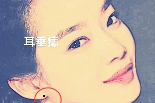 人有佛保佑的痣相(有佛保佑的人的症状) 人有佛保佑的痣相(有佛保佑的人的症状)