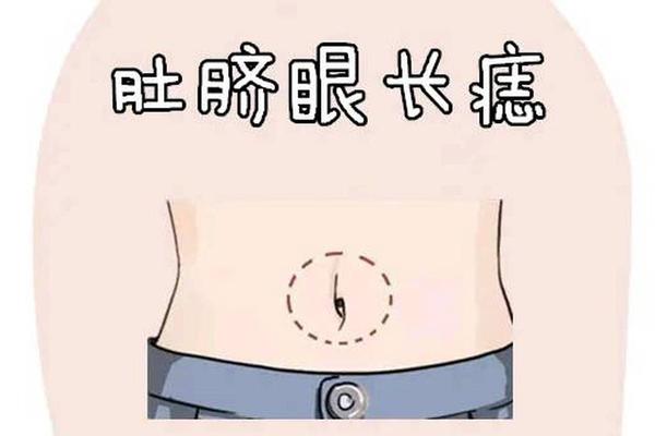 男人肚脐痣相代表什么;男人肚脐有痣图片大全 男人肚脐痣相代表什么;男人肚脐有痣图片大全