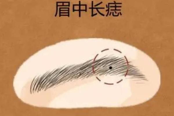修念痣相(眉中的痣修眉后露出好吗)