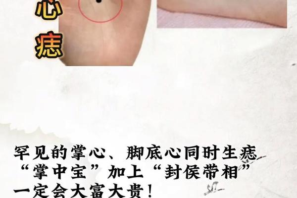面相手相痣相骨相大全 手关节有痣图解
