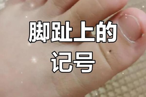 左脚拇指有痣痣相;左脚大拇指有颗痣