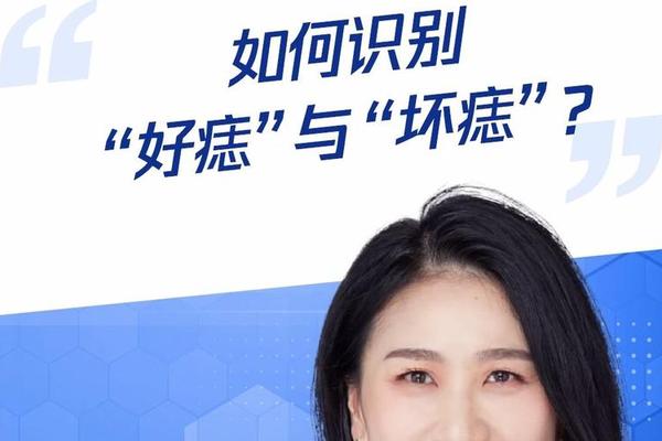 医院能看痣相吗—看痣看什么科室最好