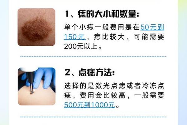 相城点痣价格-点痣50元一颗贵吗 相城点痣价格-点痣50元一颗贵吗