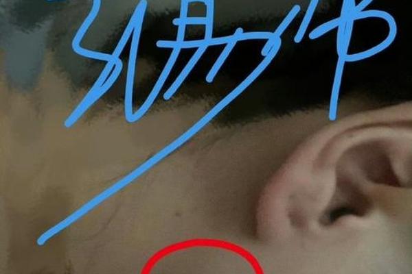 男人怎么相珍珠痣呢图片,男人有哪些痣是好的 男人怎么相珍珠痣呢图片,男人有哪些痣是好的