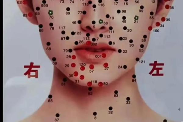 痣相在嘴唇上-嘴唇上面有痣代表什么