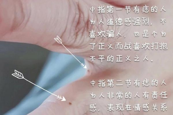 中指的痣相-中指痣代表什么寓意