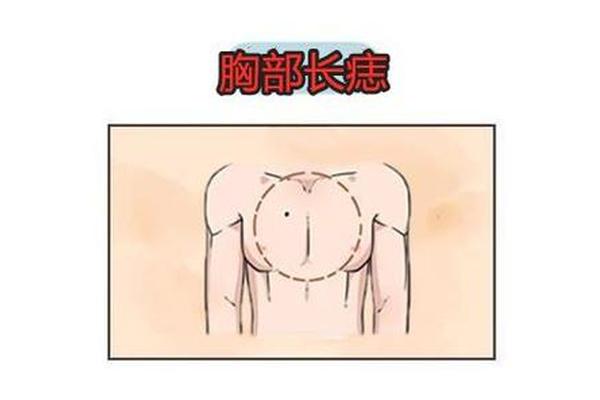左胸有痣相代表什么,左胸有颗痣意味着什么