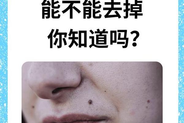 看痣相嘴巴 嘴巴上的痣叫什么痣