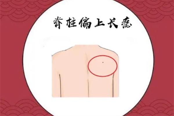 男人背相痣;男背痣图解