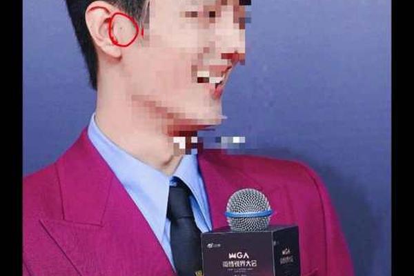 耳屏痣相男-男人耳屏长痣代表什么