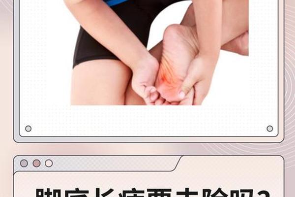 脚相脚心长痣代表什么_脚底痣相图解 脚相脚心长痣代表什么_脚底痣相图解