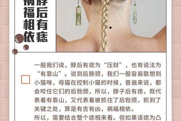 脖子侧边的痣相、脖子后侧有痣