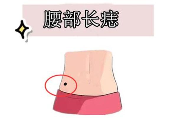 痣相肚脐右上方有痣 肚脐右边有痣