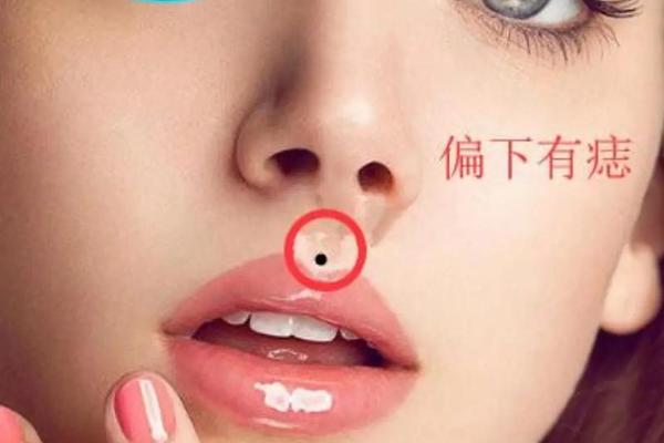 人中有痣表示什么相-人中长痣好吗