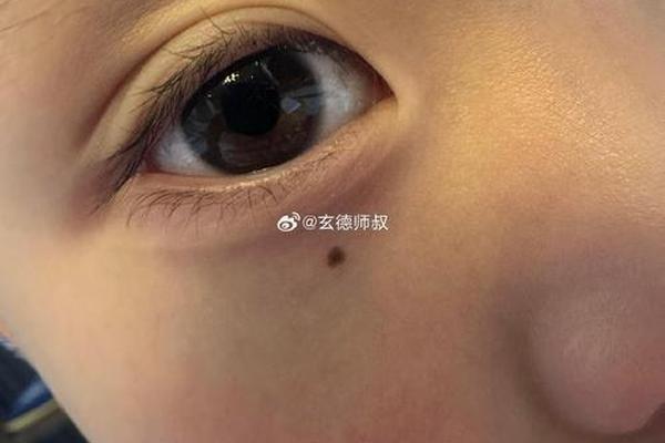 眼角下有泪痣的人相,眼角有泪痣代表什么