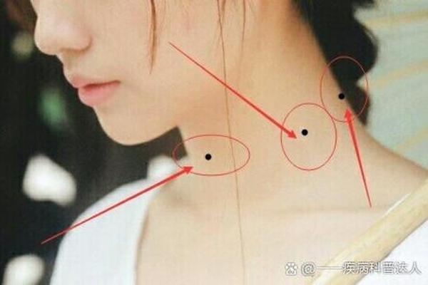 脖子两边有痣相,脖子痣相图解