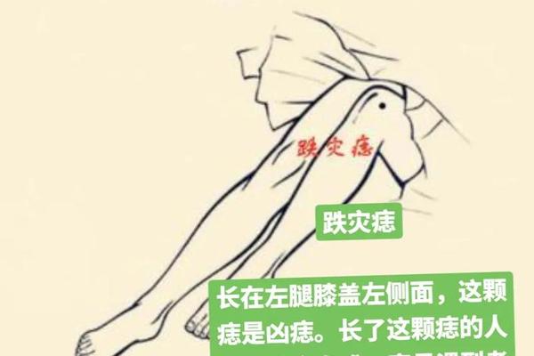 女人右腿膝盖痣相说明-右腿膝盖右侧有痣代表什么 女人右腿膝盖痣相说明-右腿膝盖右侧有痣代表什么