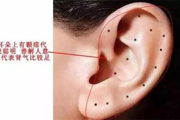 耳朵不同位置的痣相_左耳朵上的痣图解大全