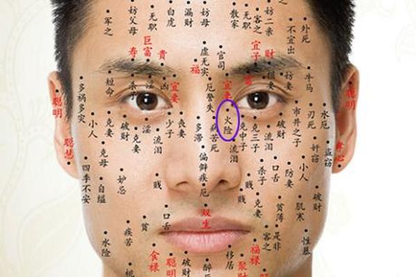 痣相男脸部痣相图—痣男人脸部痣相图解大全