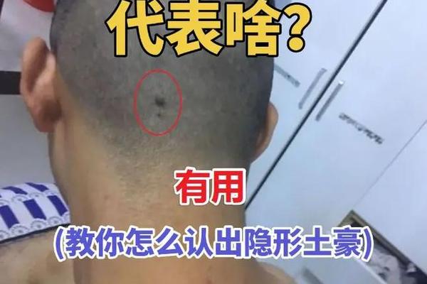 后脑勺上有痣头相 后脑勺头发里有痣