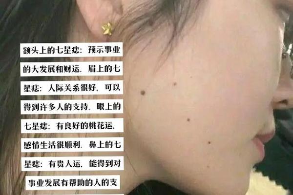 面部三星连珠痣相(三星连珠图片)