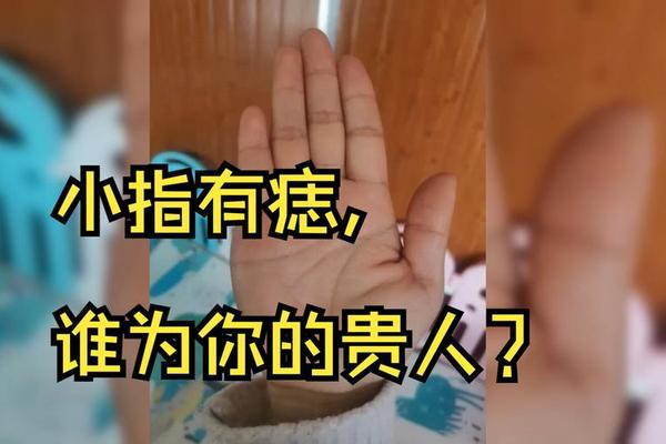 女人右小拇指上有痣好相(女人小拇指上有痣代表什么)