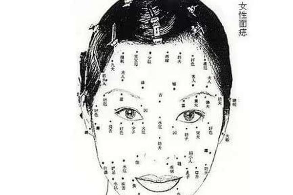 女人右阴痣相(女人外阴有痣好不好)