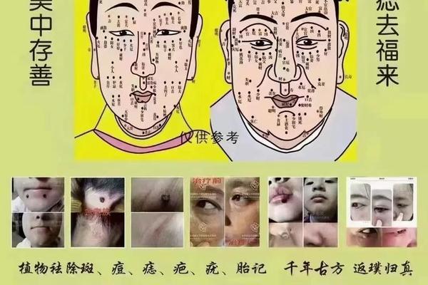 骆驼相法论痣(骆驼相法看兄弟几个的绝招)
