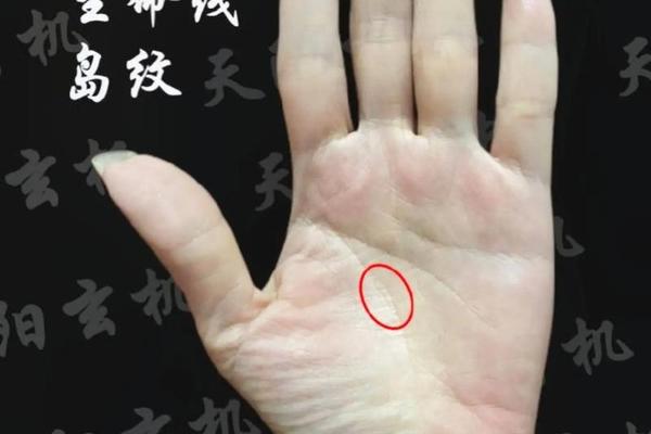金星丘上有红痣痣相、金星丘上有痣代表什么