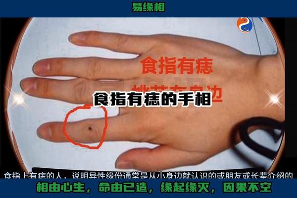 手侧痣相大全_手指内侧有痣代表什么