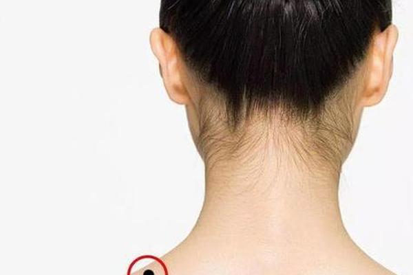 女人背痣相最准图_女生后背痣相图解大全 女人背痣相最准图_女生后背痣相图解大全