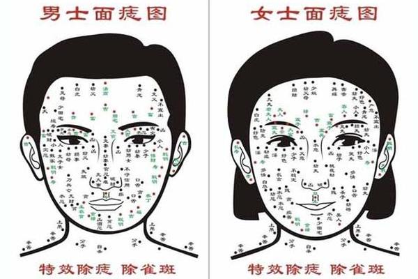 男脸痣相解图(男人脸部长痣子与命运图解)